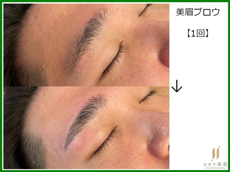 ハリウッドブロウリフト　フェイシャル脱毛 ワックス 他 進化型眉WAX！美眉ブロウHBL-ハリウッドブロウリフト- | 男のための