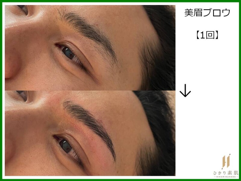 ハリウッドブロウリフト　フェイシャル脱毛 ワックス 他 進化型眉WAX！美眉ブロウHBL-ハリウッドブロウリフト- | 男のための